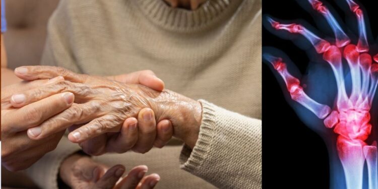 സൂക്ഷിക്കണം…-റൂമറ്റോയ്ഡ്-ആര്‍ത്രൈറ്റിസ്;-പ്രാഥമിക-ലക്ഷണങ്ങള്‍-എന്തൊക്ക.?