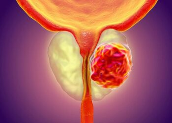 സെക്‌സ്-പുരുഷന്മാരെ-ബാധിയ്ക്കുന്ന-പ്രോസ്റ്റേറ്റ്-കാന്‍സര്‍-സാധ്യത-കുറയ്ക്കും;-ആഴ്ചയില്‍-മൂന്നു-പ്രാവശ്യമെങ്കിലും-സെക്‌സിലേര്‍പ്പെട്ടാല്‍-പത്തുവര്‍ഷം-പ്രായക്കുറവ്-തോന്നിക്കുമത്രെ.!