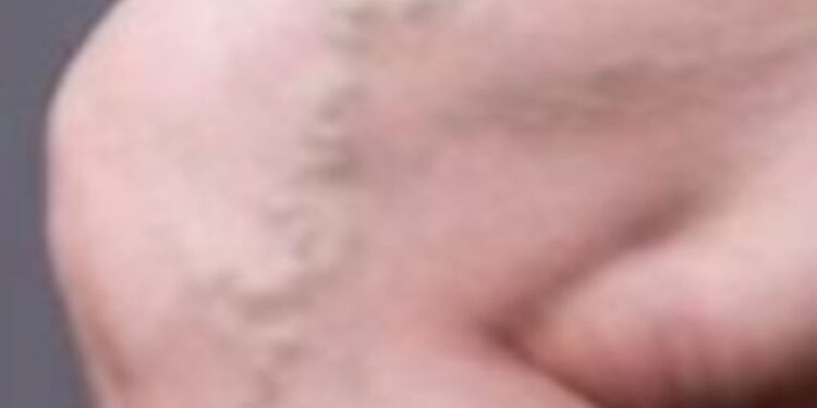 ഞരമ്പു-വീക്കത്തിന്-കാരണങ്ങള്‍…