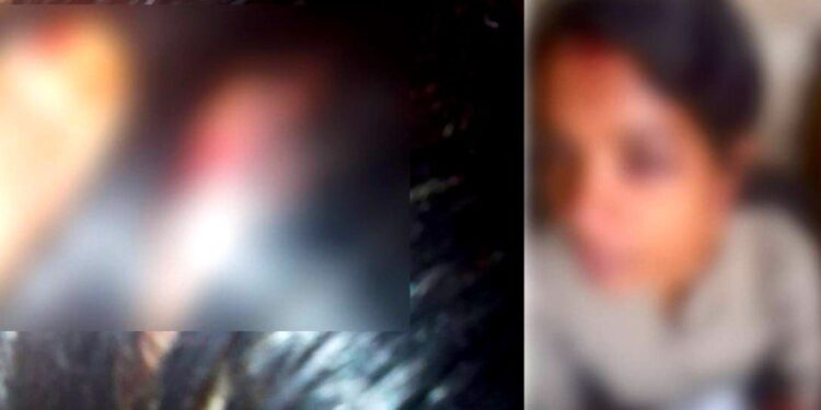 പിതാവിന്‍റെ ക്രൂരമർദനം സഹിക്കവയ്യാതെ; 14 വയസുകാരി ആത്മഹത്യക്ക് ശ്രമിച്ചു, ഗുരുതരാവസ്ഥയിൽ