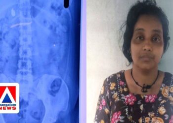 മോഷ്ടിച്ച മാല യുവതി വിഴുങ്ങി; ആഭരണം വീണ്ടെടുക്കാൻ ‘കാത്തിരുന്ന്’ പോലീസ്; സംഭവം നിലമ്പൂരിൽ