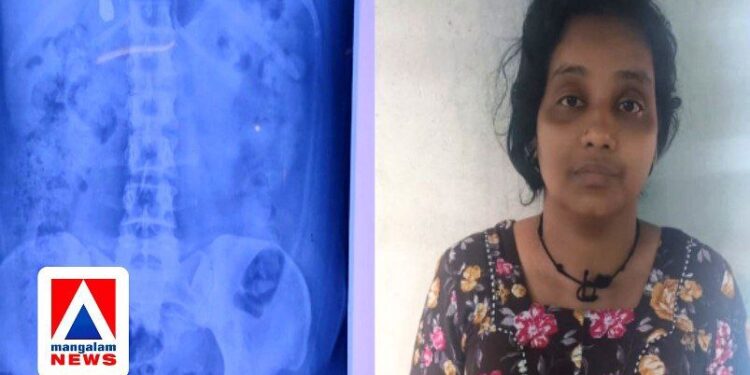 മോഷ്ടിച്ച മാല യുവതി വിഴുങ്ങി; ആഭരണം വീണ്ടെടുക്കാൻ ‘കാത്തിരുന്ന്’ പോലീസ്; സംഭവം നിലമ്പൂരിൽ